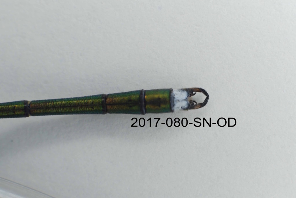 anal appendages dorsal