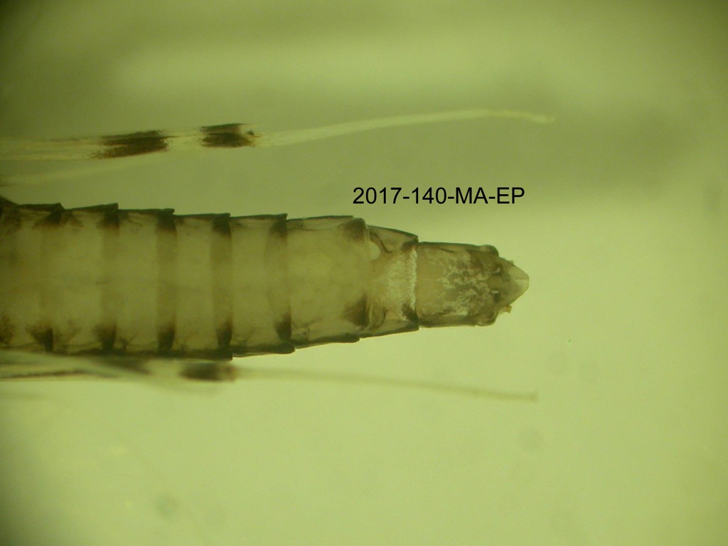 abdomen ventral