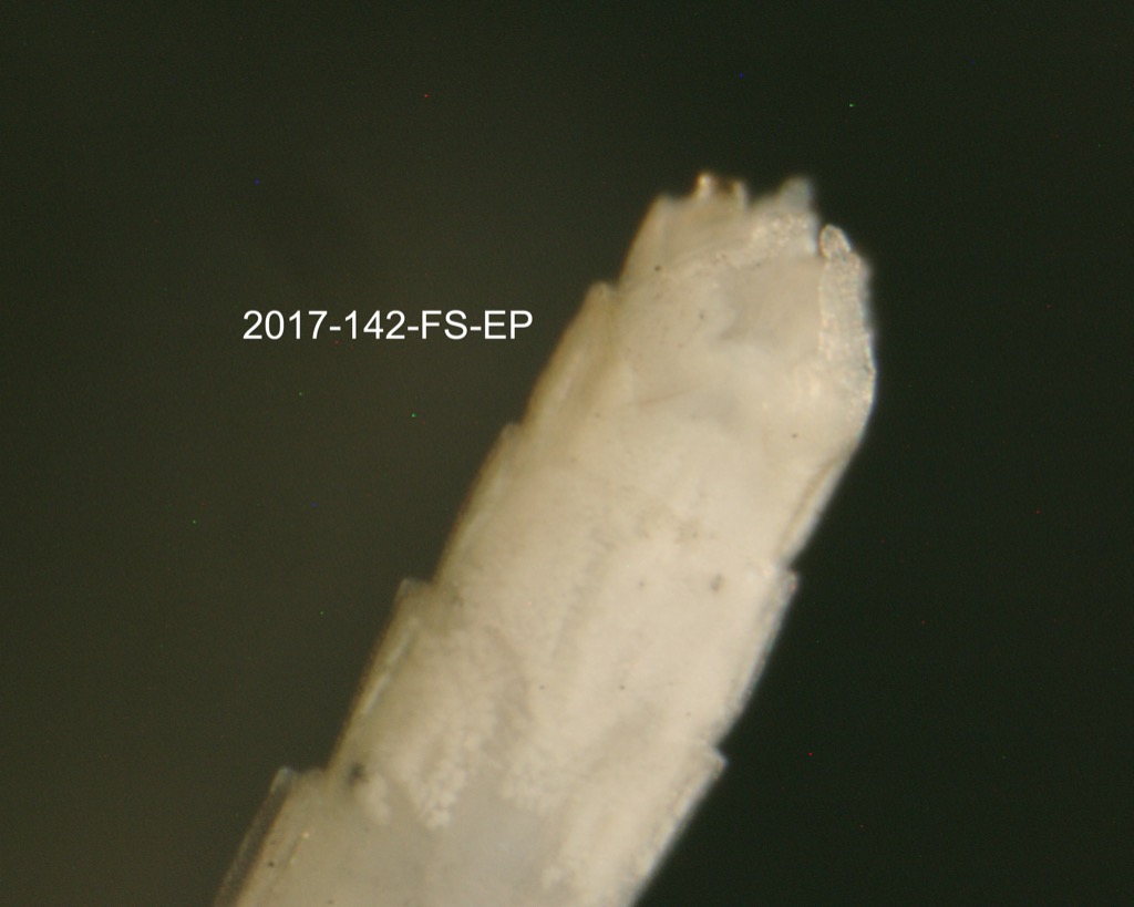 genitalia ventral