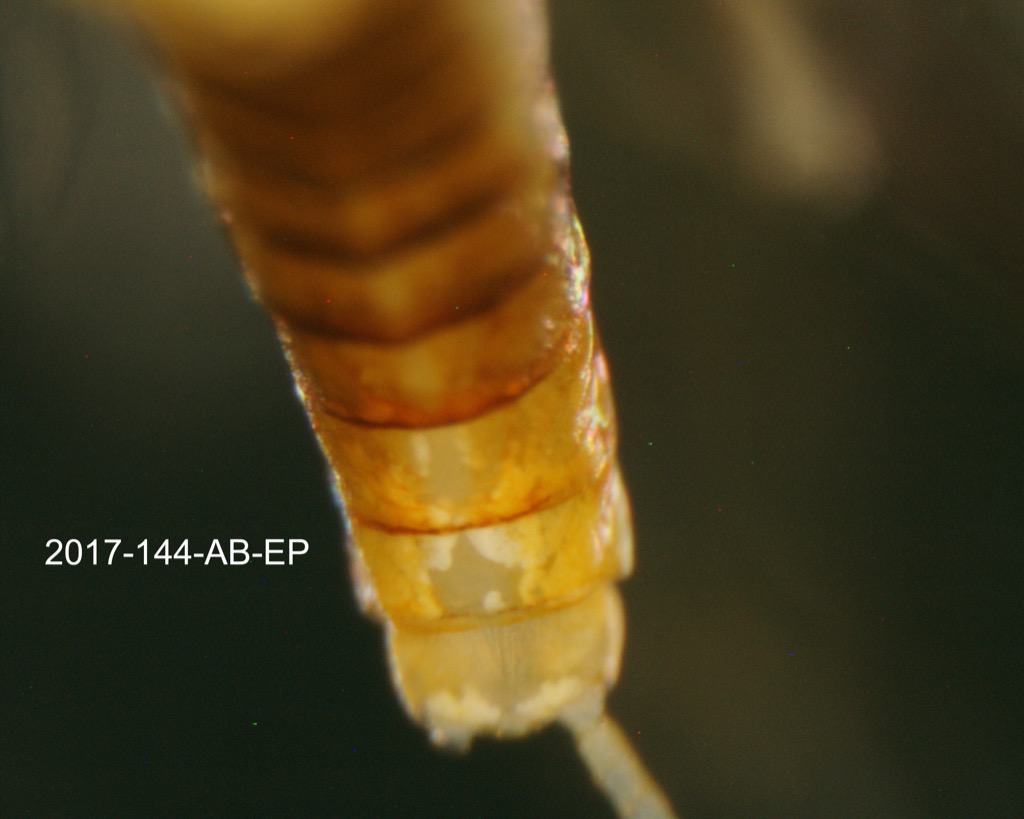 abdomen dorsal