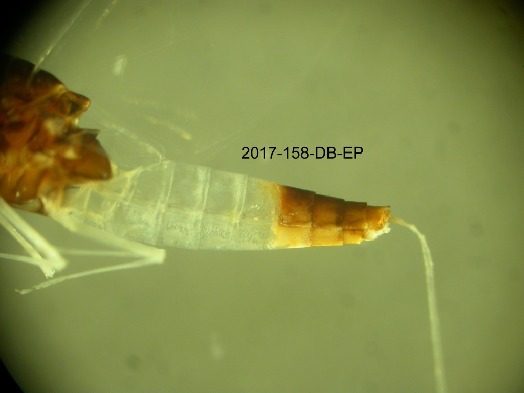 abdomen lateral