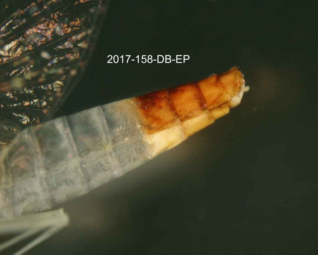 abdomen lateral