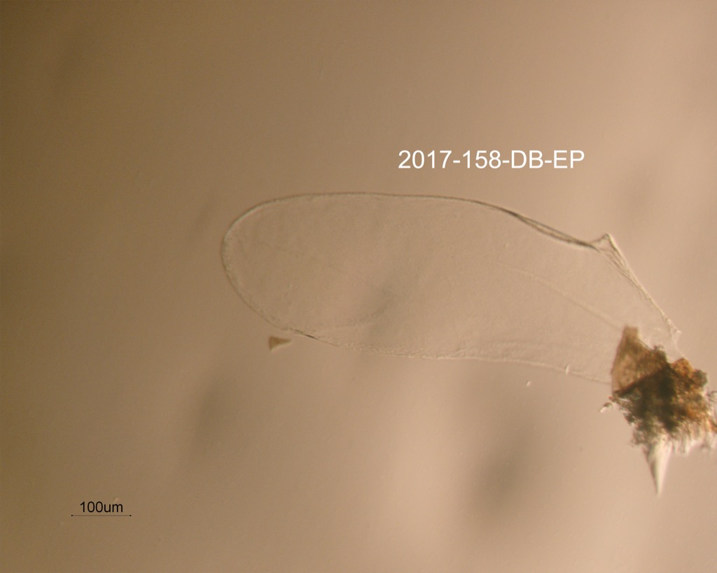 hindwing