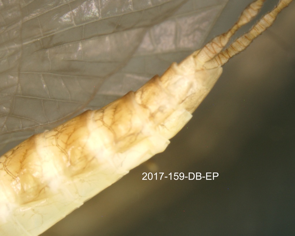 abdomen lateral