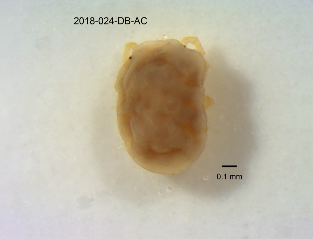 dorsal