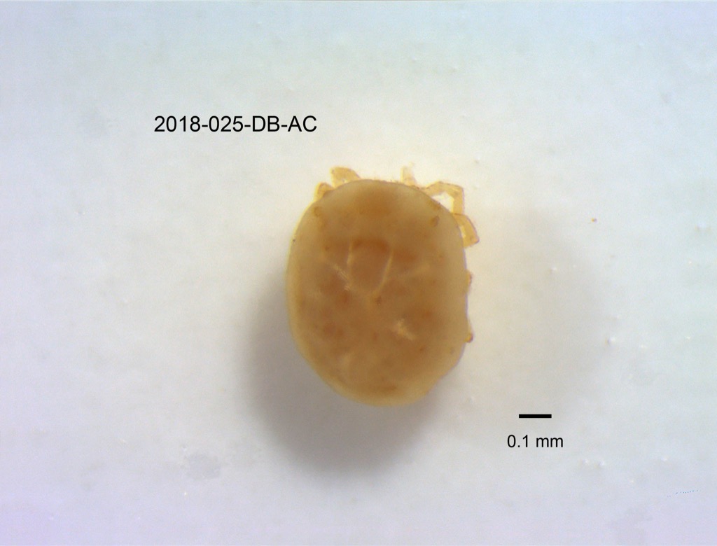 dorsal