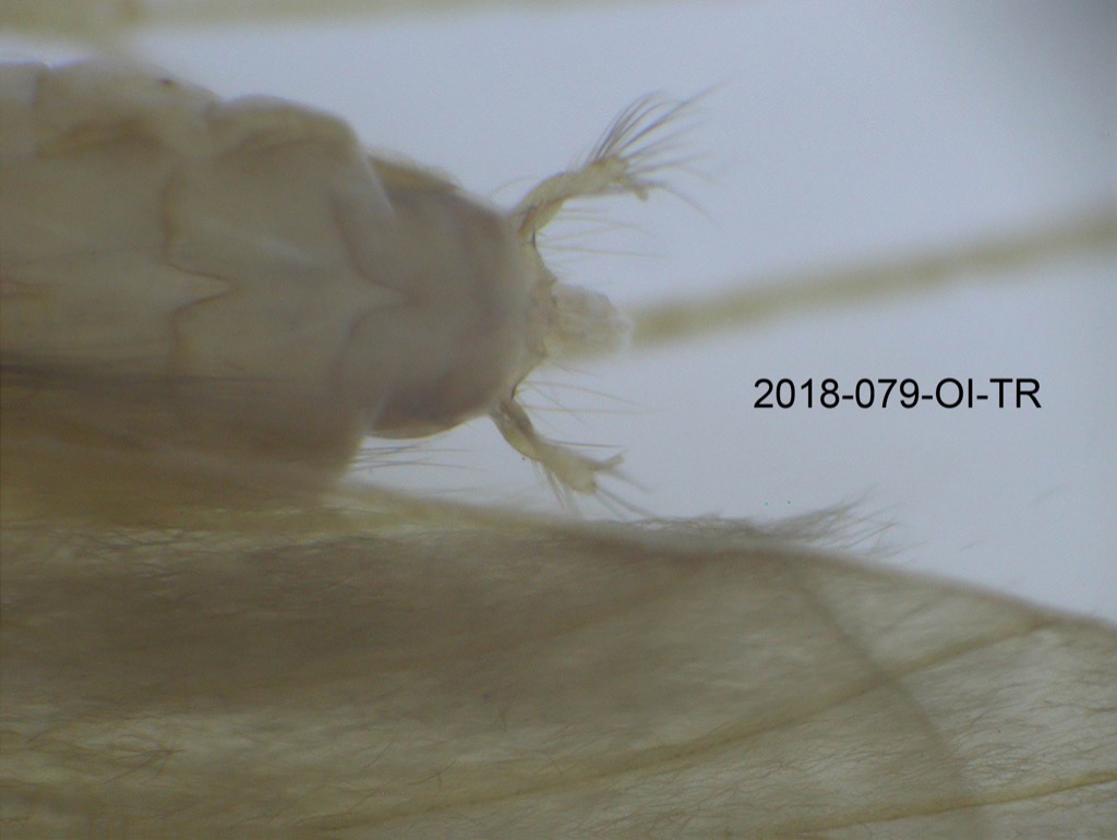 genitalia dorsal
