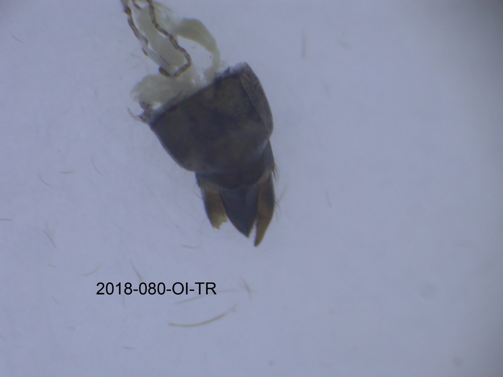 genitalia dorsal