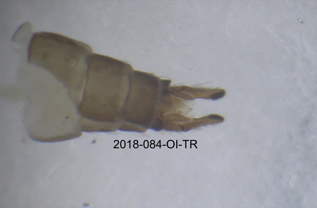 genitalia dorsal