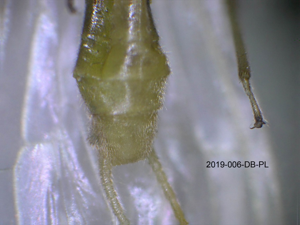 abdomen ventral