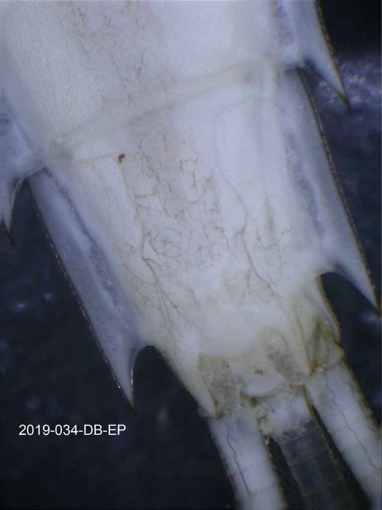 abdominal apex ventral