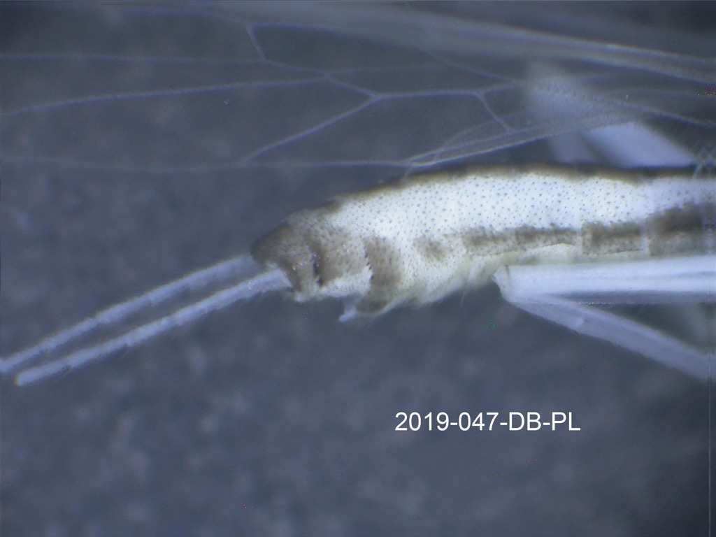 abdomen lateral