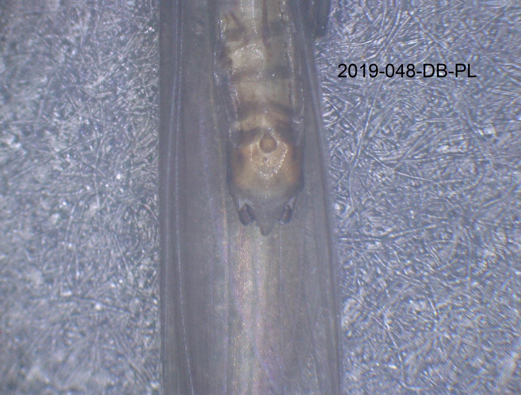 genitalia ventral