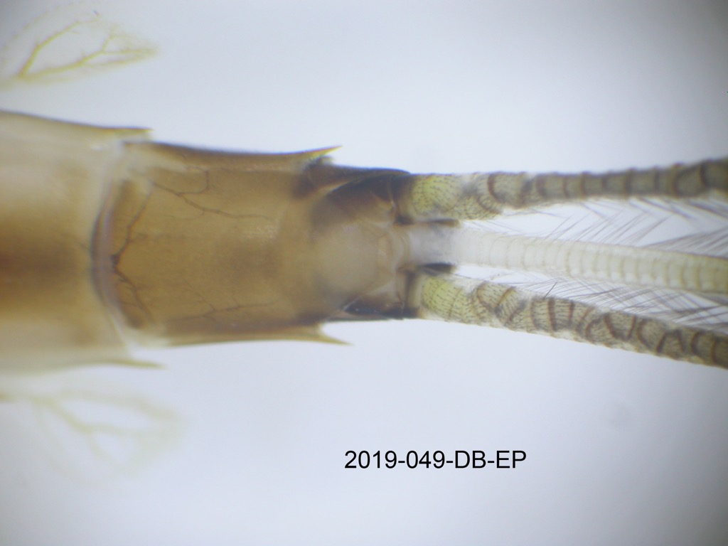 abdominal apex ventral