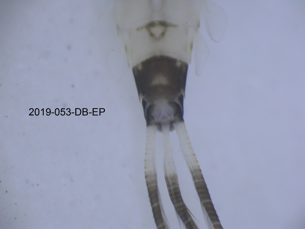 abdominal apex ventral