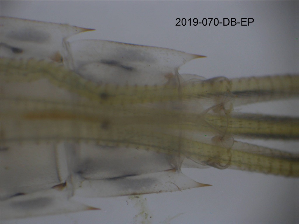 abdominal apex ventral