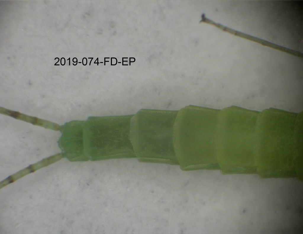 abdomen ventral
