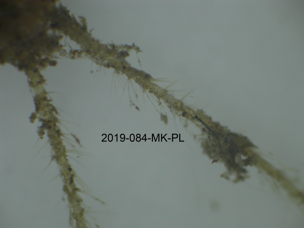 cerci dorsal