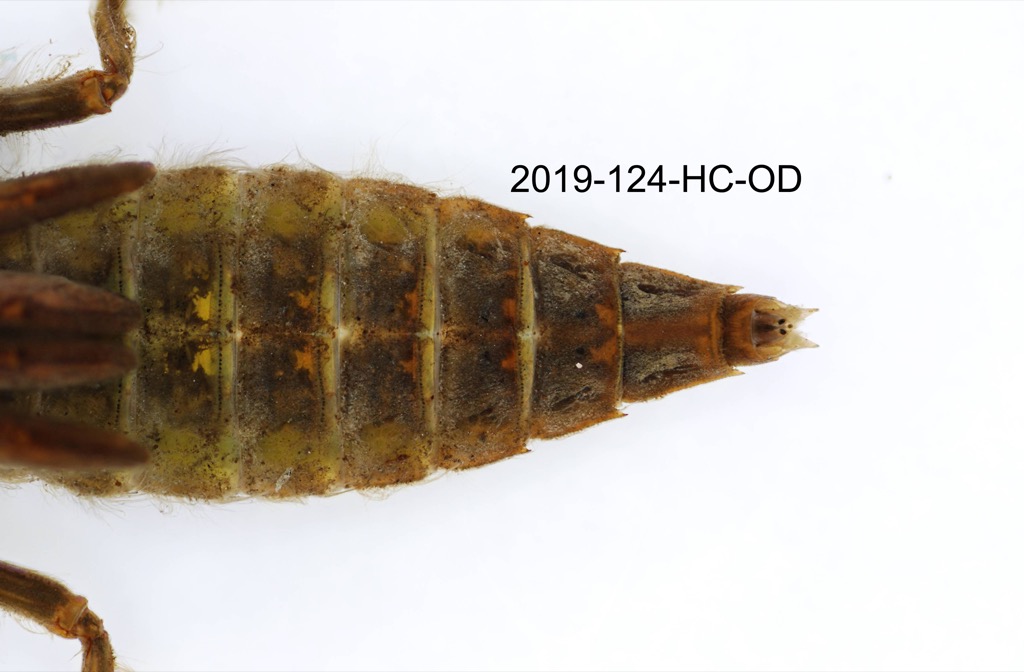 abdomen dorsal