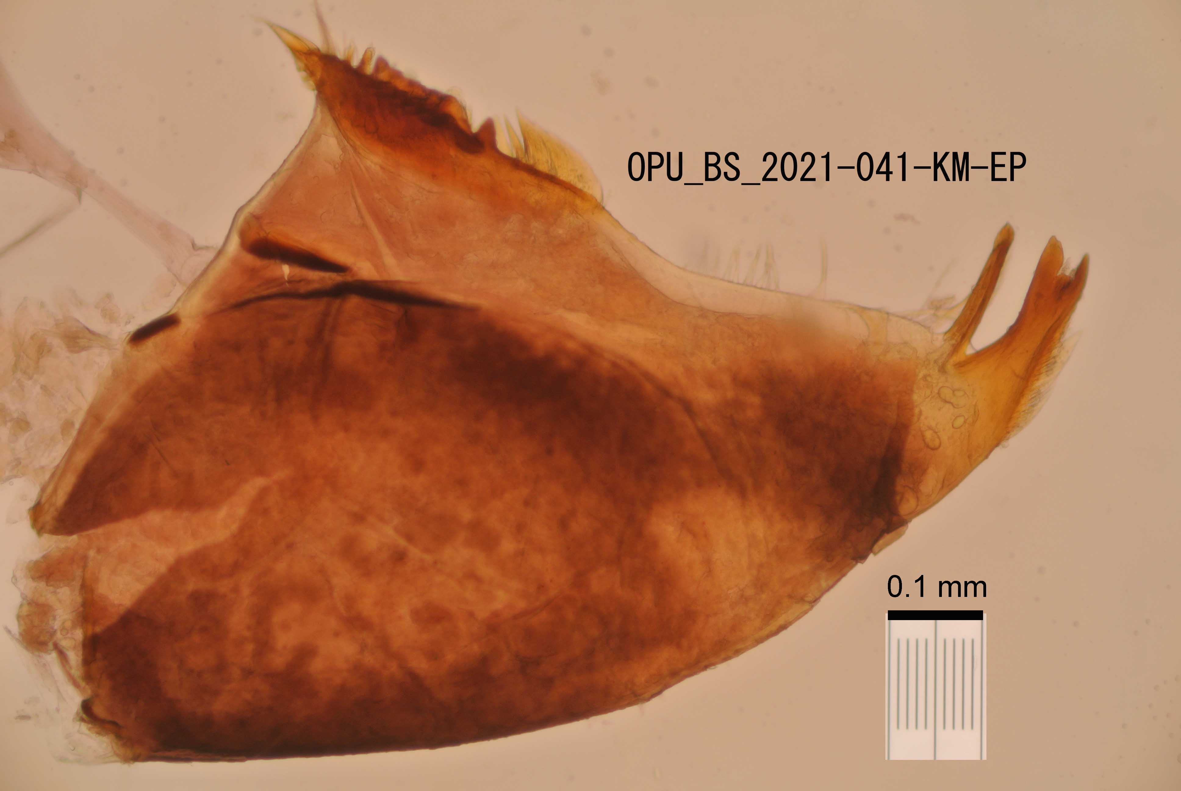 mandible