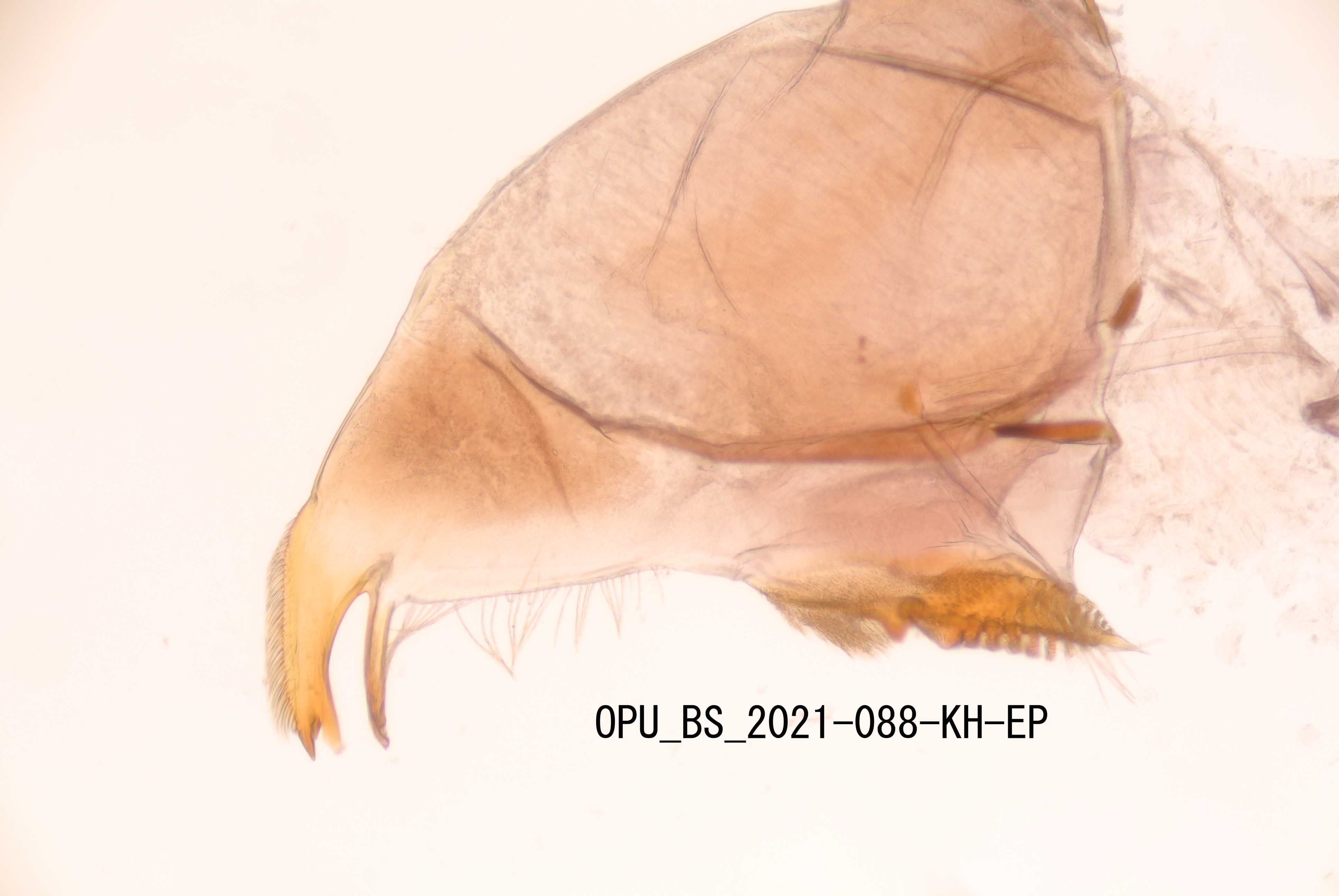 mandible