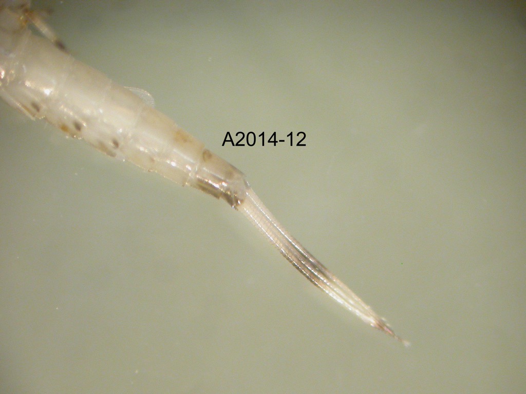 abdomen ventral