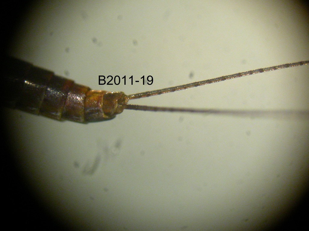 abdominal apex dorsal