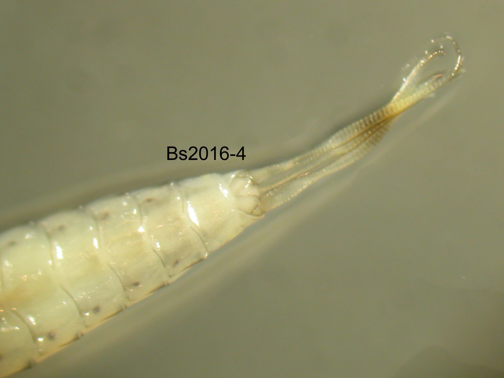 abdominal apex ventral