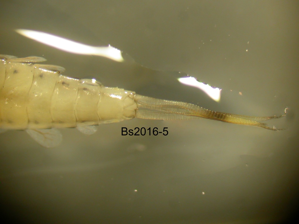 abdominal apex ventral
