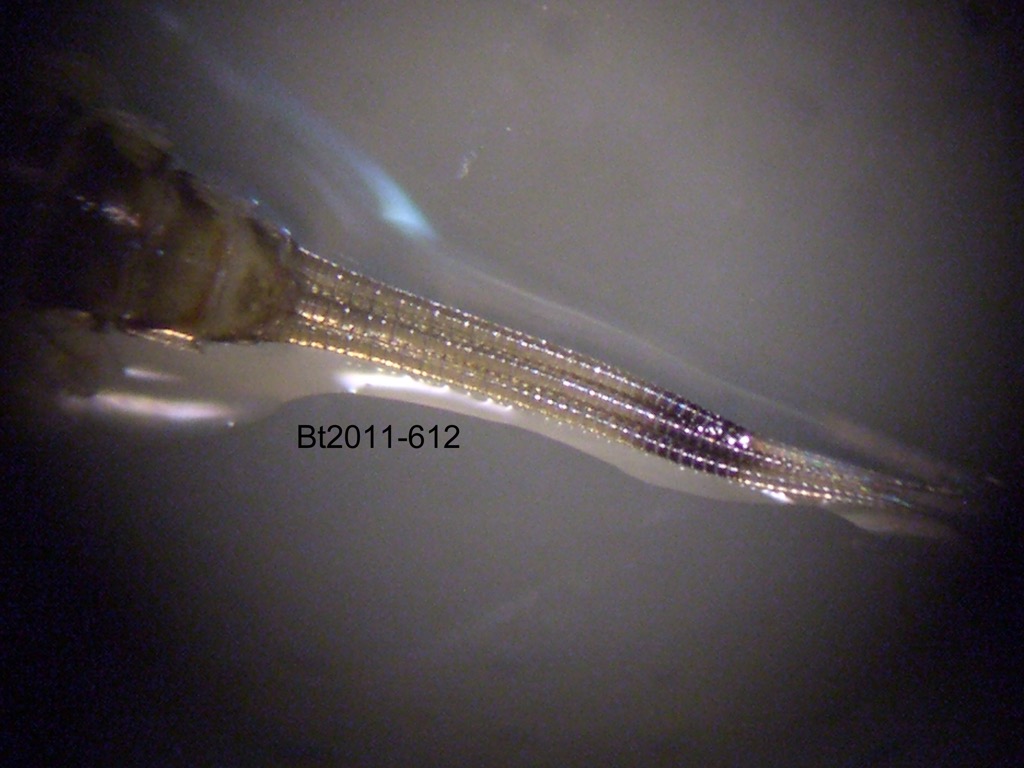 abdominal apex dorsal