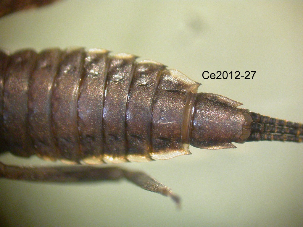 abdomen ventral