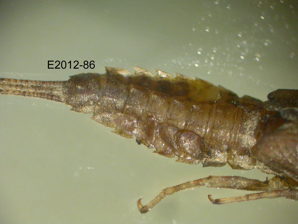 abdomen dorsal