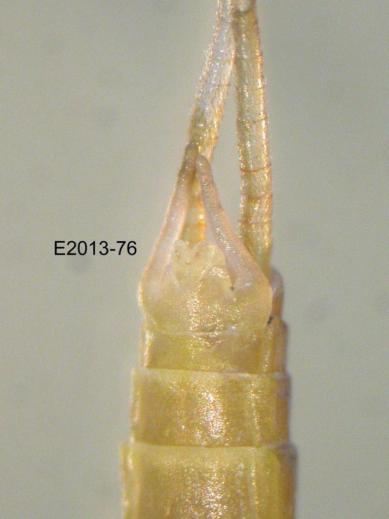 genitalia ventral