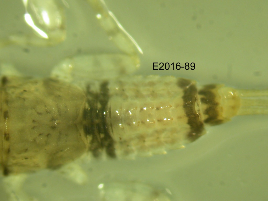 abdomen dorsal