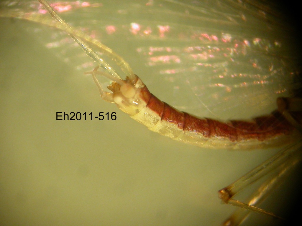 abdomen lateral