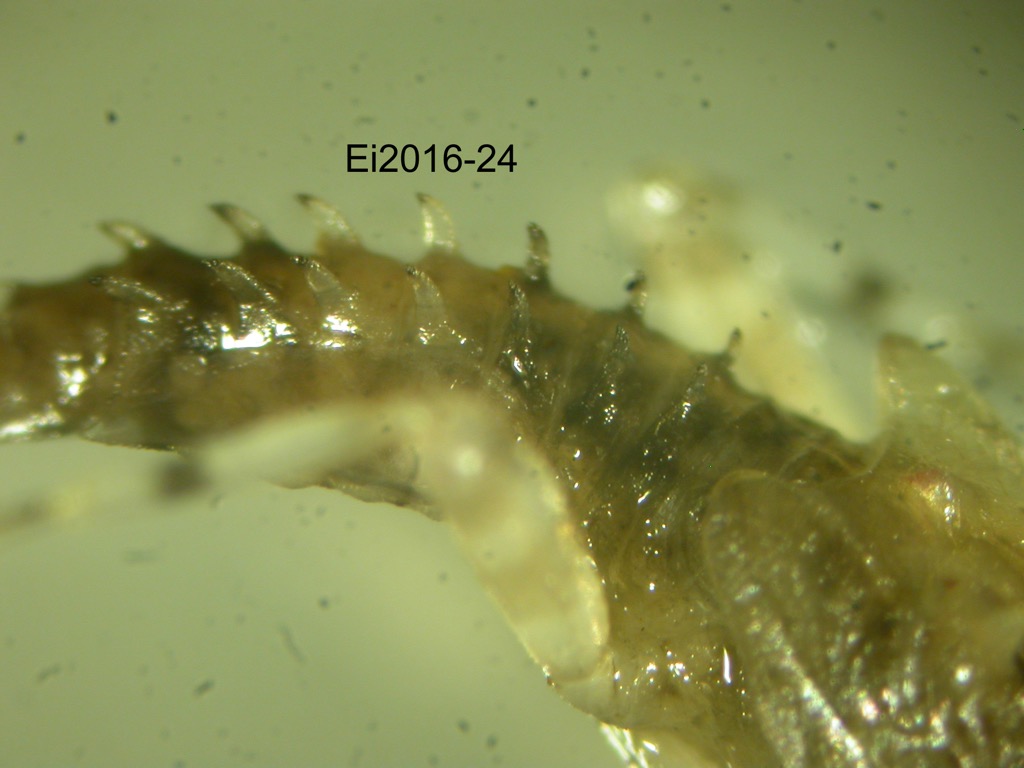abdomen lateral
