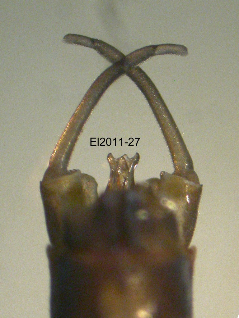 genitalia dorsal