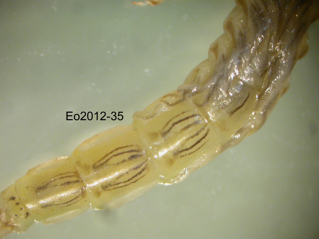 abdomen dorsal