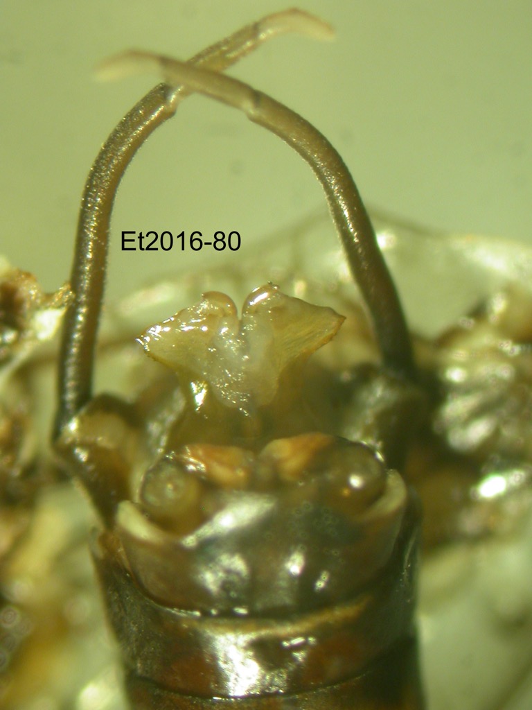 genitalia dorsal