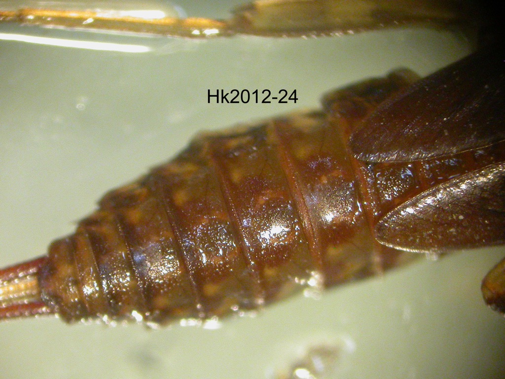 abdomen dorsal