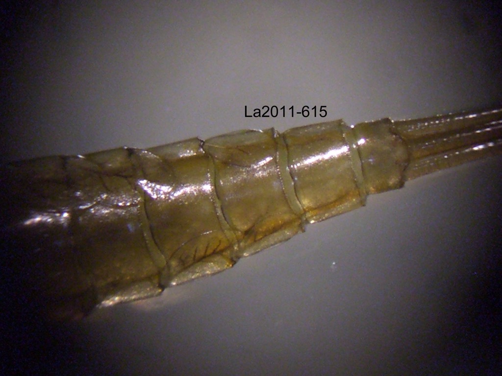 abdominal apex dorsal