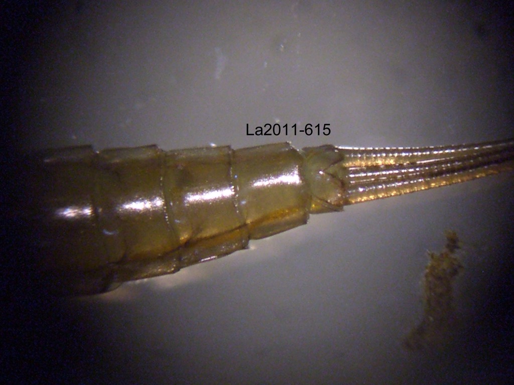 abdominal apex ventral