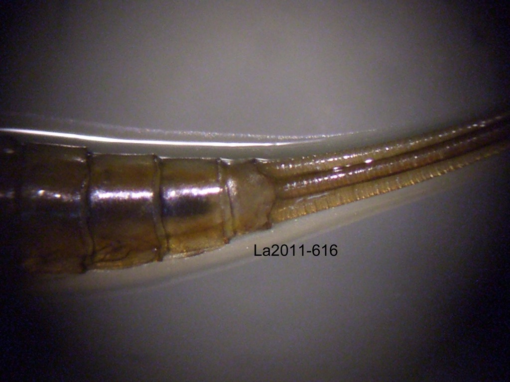 abdominal apex dorsal