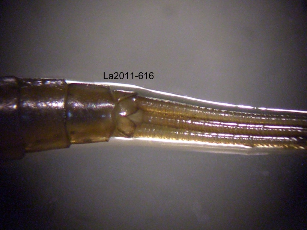 abdominal apex ventral
