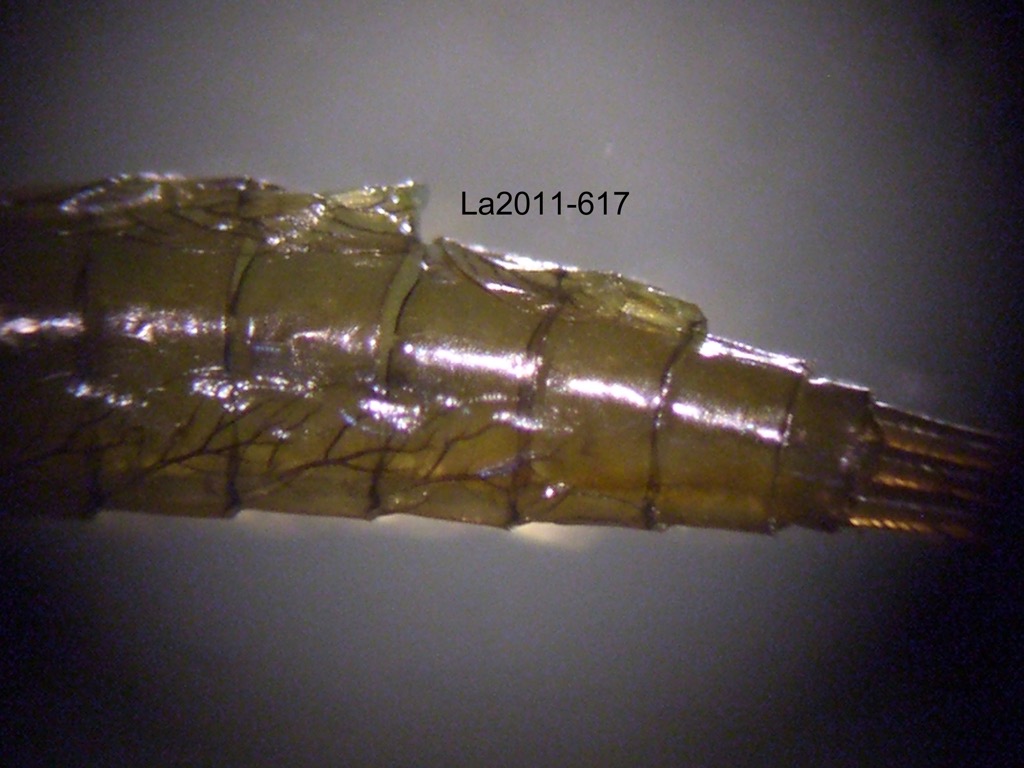 abdomen dorsal