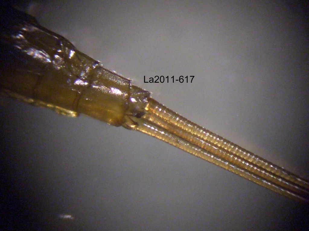 abdominal apex ventral