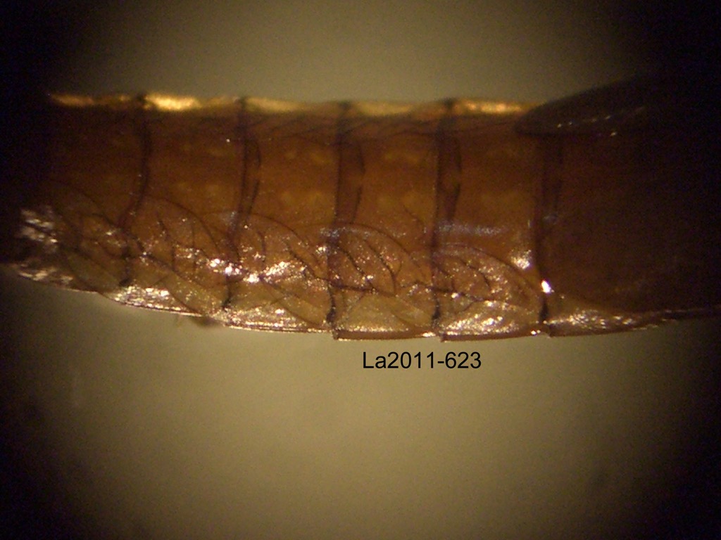 abdomen dorsal