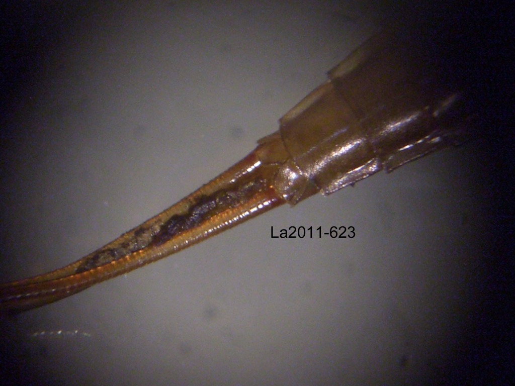 abdominal apex ventral