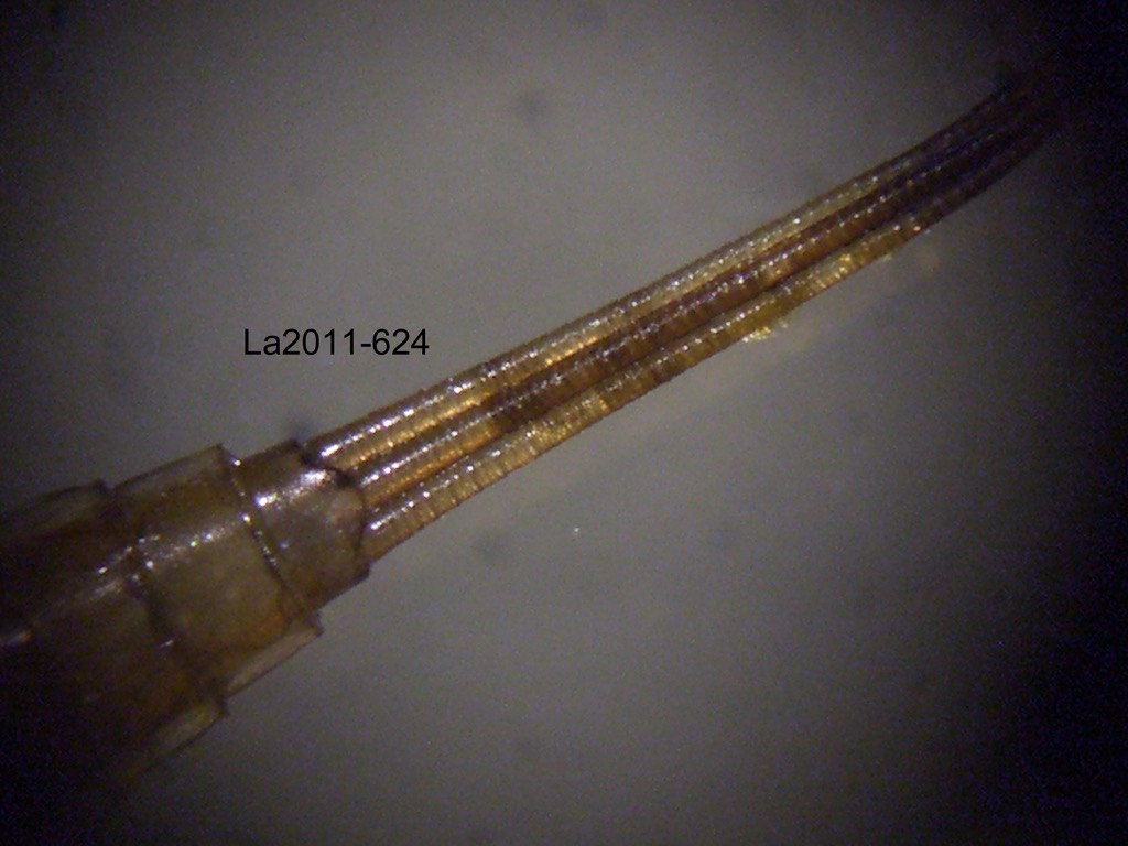 abdominal apex dorsal