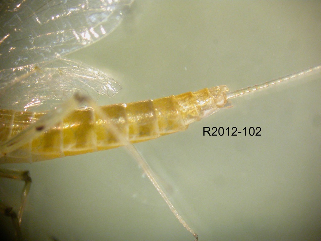 abdomen lateral